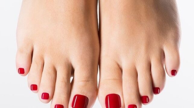 Laserbehandlung des Nagelpilzes